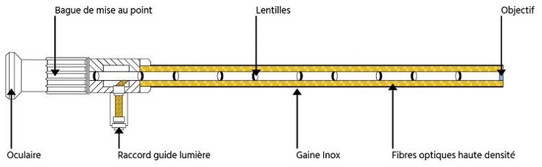 qu'est-ce qu'un endoscope rigide ?